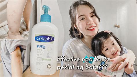 gamot sa peklat ng bata|How to Choose the Best Peklat Remover for Your Skin.